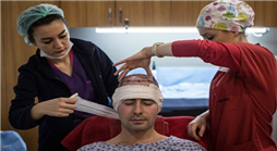 تركيا تجني مليار دولار في 2018 من عمليات زراعة الشعر